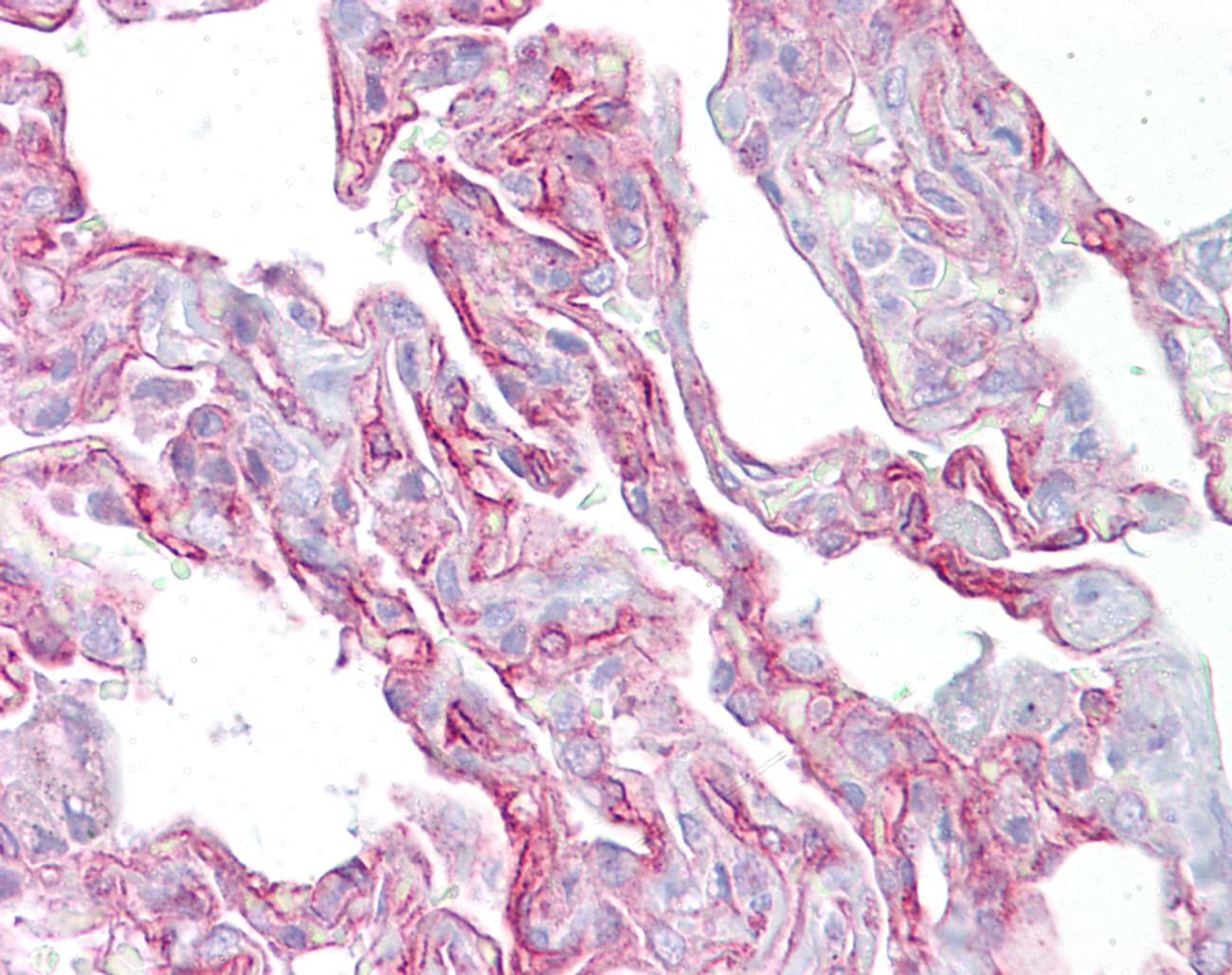 Polyclonal Rabbit anti-Mouse PTHLH / PTHRP Antibody (aa77-126, IHC, WB)