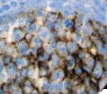 Monoclonal Mouse anti-Human CR1 / CD35 Antibody (clone RLB25, IHC)
