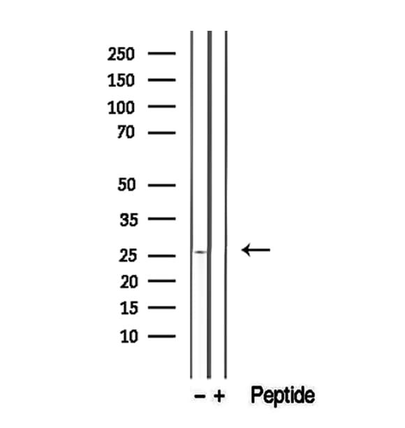 Polyclonal Rabbit anti-Human GSTM4-4 / GSTM4 Antibody (IHC, IF, WB)