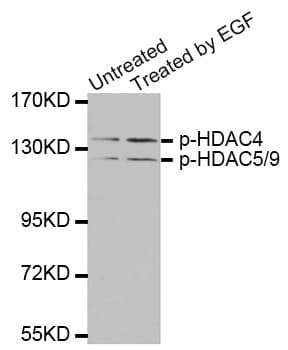 Polyclonal Rabbit anti-Human HDAC4/5/9 Antibody (phospho-Ser246/259/220, IHC, WB)
