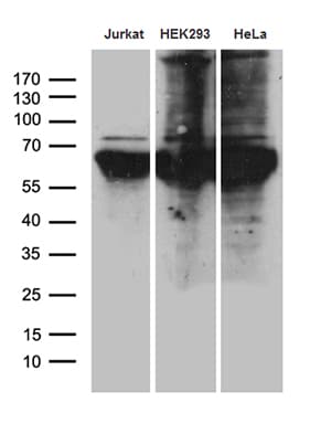 PPM1D / WIP1 Antibody (aa1-375, clone OTI4H3)
