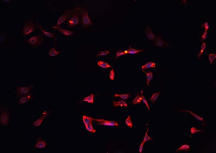 SOX6 Antibody