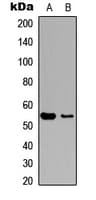 Polyclonal Rabbit anti-Human MEF2C Antibody (C-Terminus, IHC, IF, WB)
