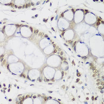 CBX3 / HP1 Gamma Antibody