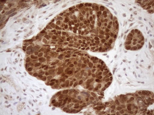 MGMT Antibody (clone OTI10H9)