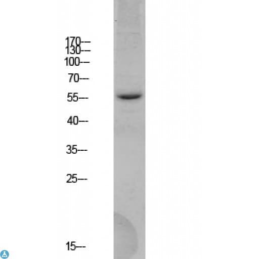 BACE1 / BACE Antibody