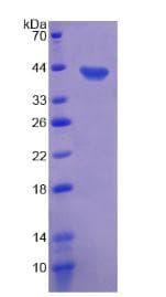 Rat XCL1 / Lymphotactin Protein (Recombinant His-GST, N-terminus)