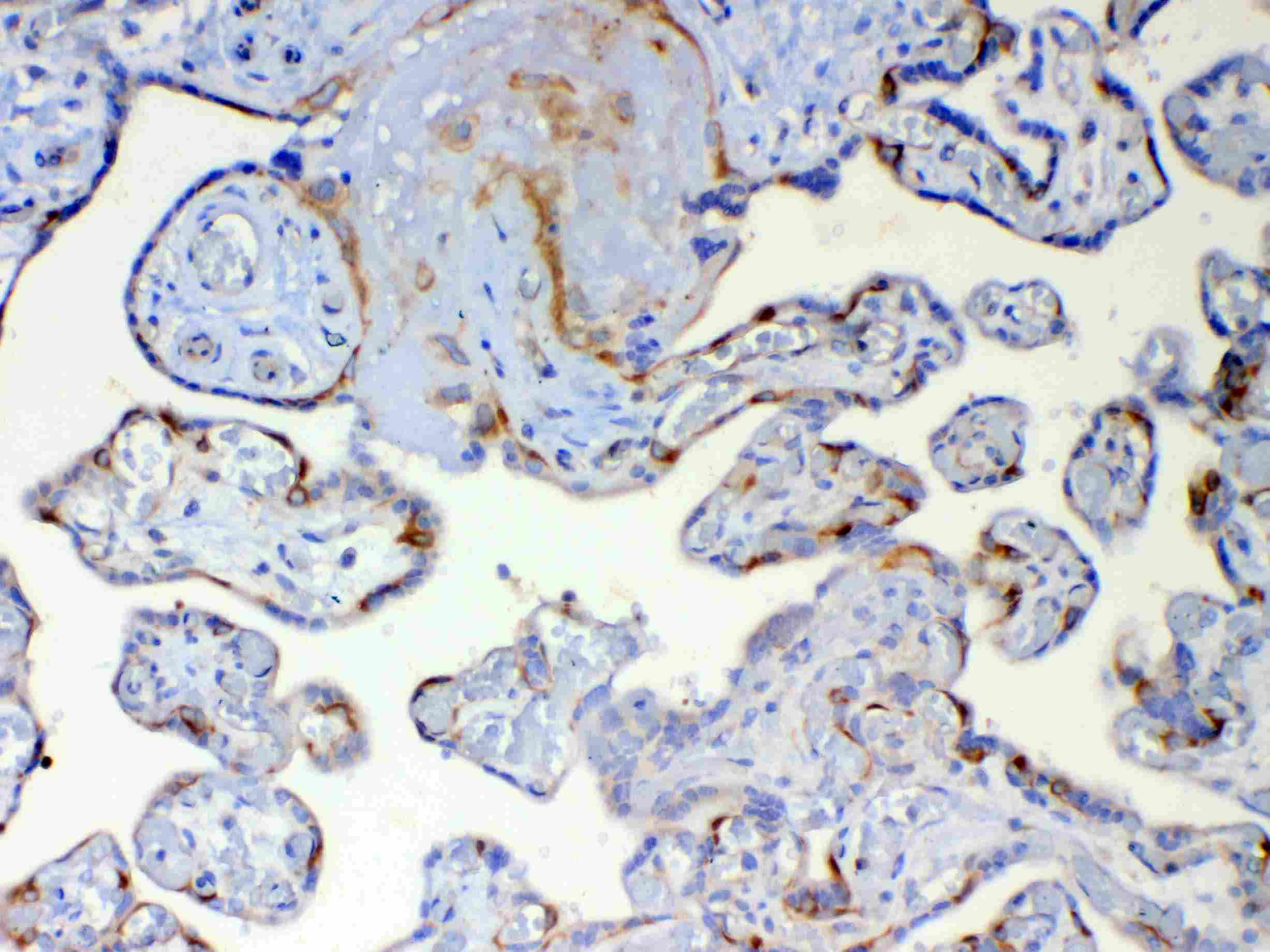Polyclonal Rabbit anti-Human DYNLT1 / TCTEX-1 Antibody (IHC, WB)