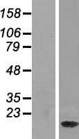 NDUFAF3 Protein (Over-Expression Lysate Myc-DDK (Flag))