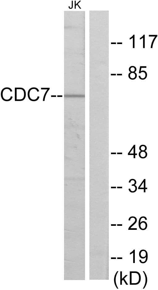 Polyclonal Rabbit anti-Human CDC7 Antibody (aa1-50, WB)
