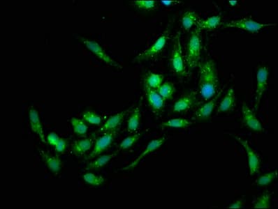 HEDLS / EDC4 Antibody