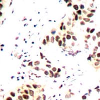 AURKB / Aurora-B Antibody (N-Terminus)