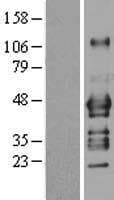 ADRM1 Protein (Over-Expression Lysate Myc-DDK (Flag))