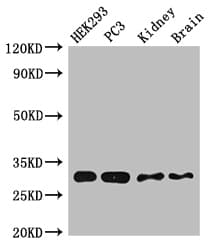 CBR / CBR1 Antibody
