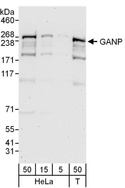 MCM3AP / GANP Antibody (aa1930-1980)