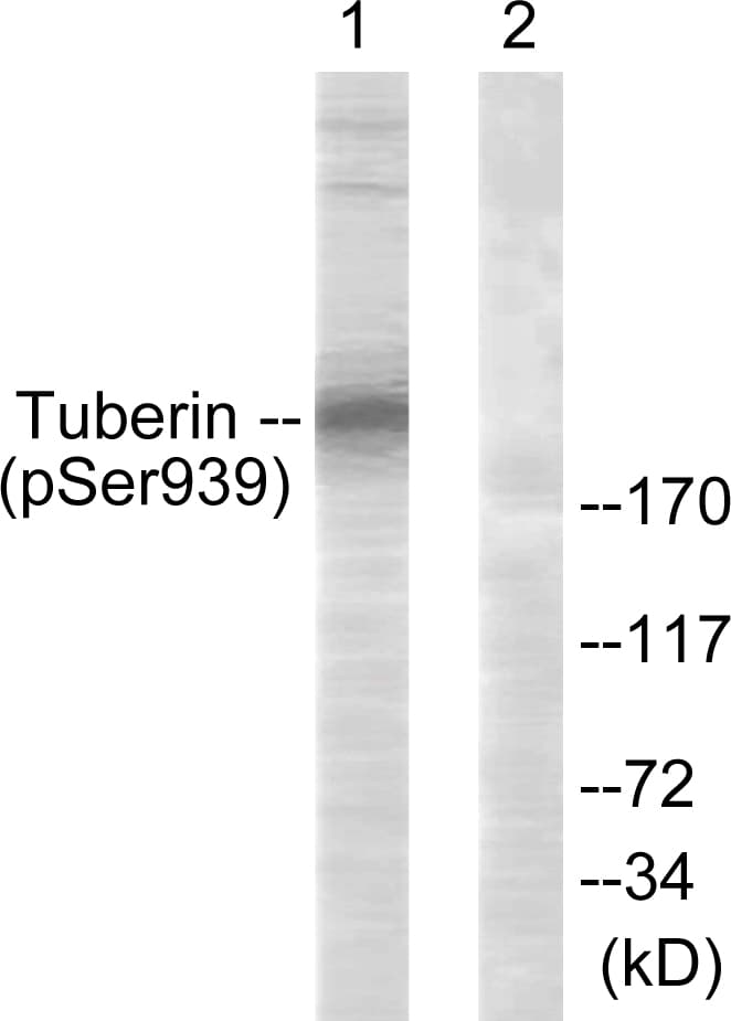 Tuberin / TSC2 Antibody (phospho-Ser939)