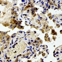 Polyclonal Rabbit anti-Human RPS20 / Ribosomal Protein S20 Antibody (Internal, IHC, IF, WB)
