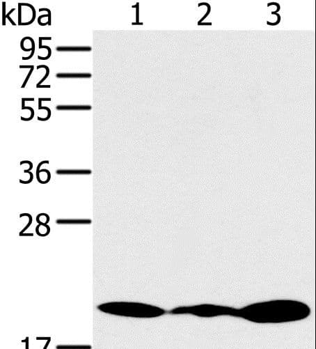 Polyclonal Rabbit anti-Human RMA1 / RNF5 Antibody (IHC, WB)