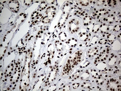 Monoclonal Mouse anti-Human SMC1A / SMC1 Antibody (clone OTI2D12, aa889-1016, IHC, WB)