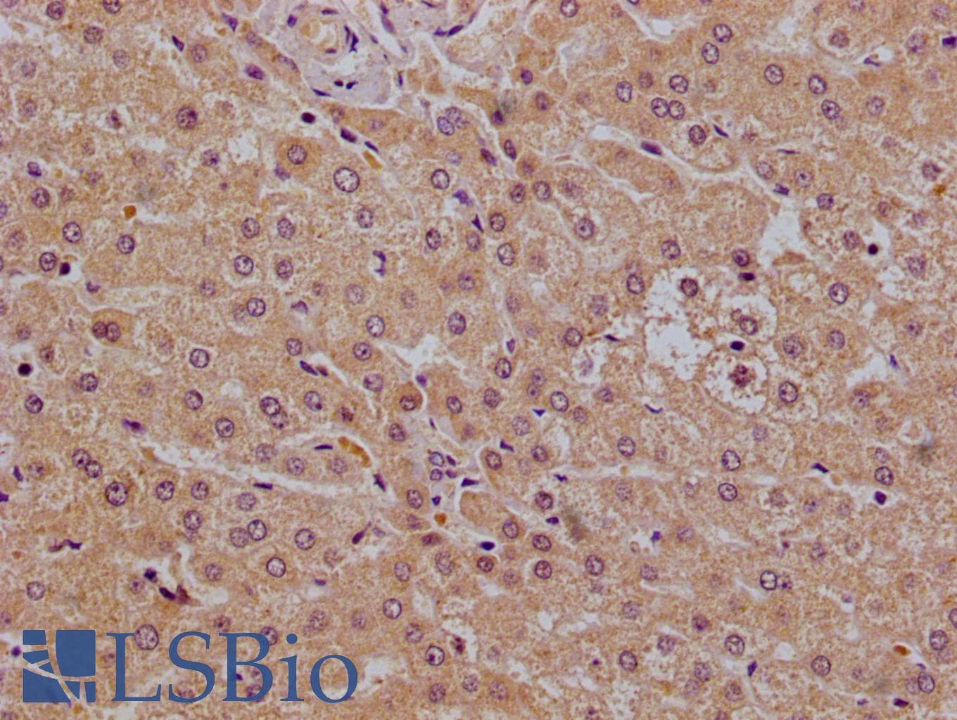 Polyclonal Rabbit anti-Human PHLDA3 Antibody (IHC)