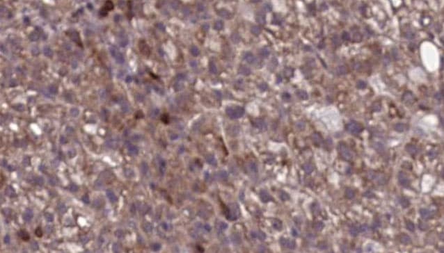 SCARB1 / SR-BI Antibody
