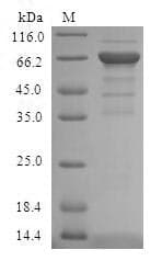 Human ADH4 Protein (Recombinant GST, N-terminus)