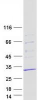 Human SNRPB / COD Protein (Recombinant Myc-DDK (Flag))