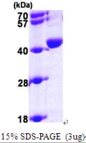 Human UROD Protein (Recombinant His)