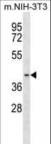 BCKDK Antibody (aa159-188)