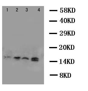 CSTB / Cystatin B / Stefin B Antibody (aa26-45)