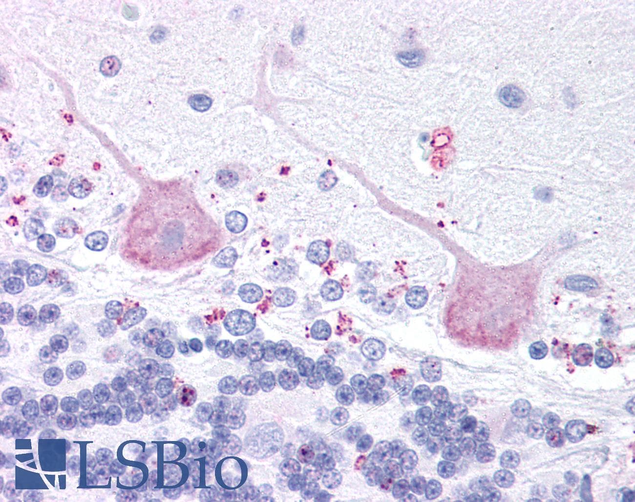 IHC-plus™ Polyclonal Rabbit anti-Human MCHR2 Antibody (C-Terminus, IHC)