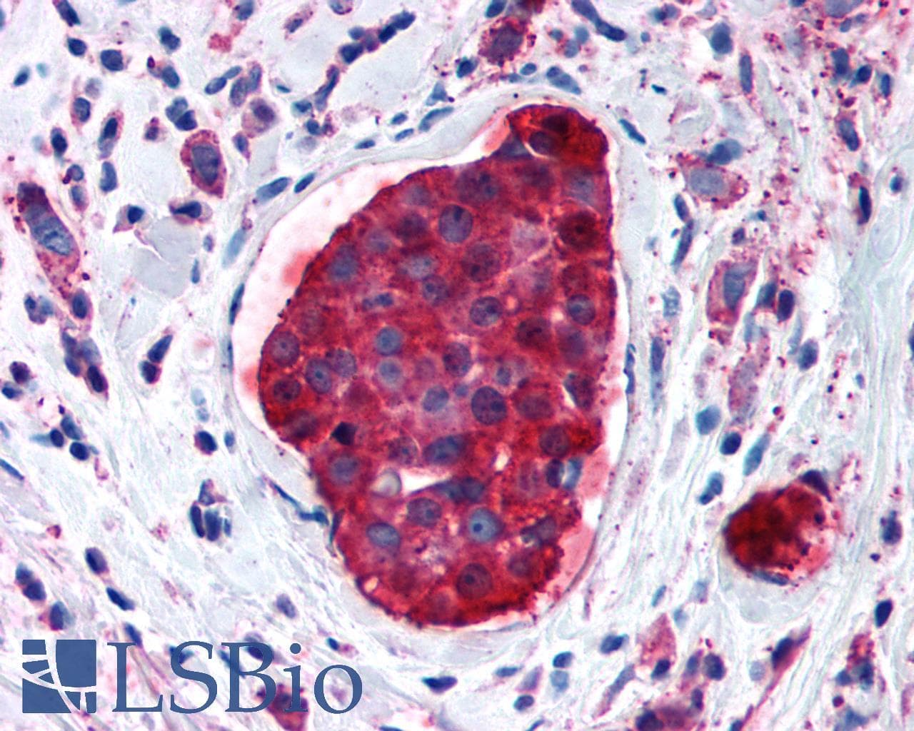 PathPlus™ GPRC5A / RAI3 Antibody (Transmembrane Domain)