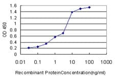 IHC-plus™ HADH Antibody (clone 4B5)