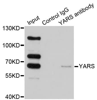 YARS / Tyrosyl-tRNA Synthetase Antibody