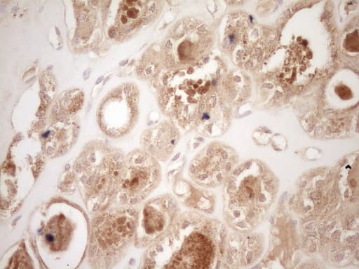 Monoclonal Mouse anti-Human CALCA Antibody (clone 2D12, IHC, WB)
