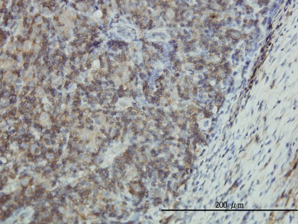 Monoclonal Mouse anti-Human EMP3 Antibody (clone 3D4, IHC, WB)