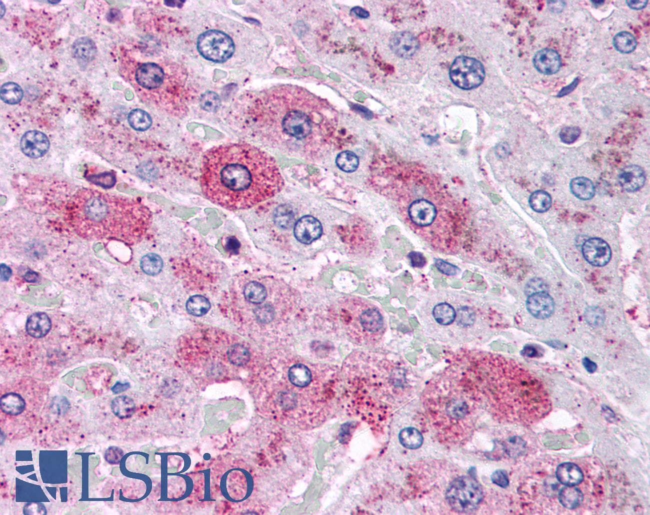 IHC-plus™ Polyclonal Rabbit anti-Human GCGR / Glucagon Receptor Antibody (N-Terminus, IHC)