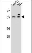 IHC-plus™ Polyclonal Rabbit anti-Human ZFP91 Antibody (aa216-245, IHC, WB)