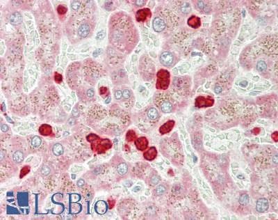 Polyclonal Rabbit anti-Human OTC Antibody (aa78-342, IHC, WB)