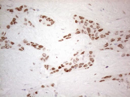 HDAC2 Antibody (aa415-488, clone OTI7E10)