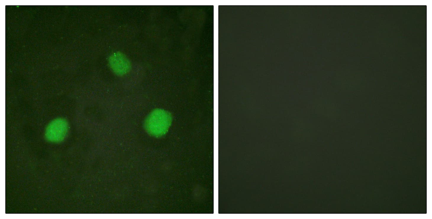 Histone H3.3 Antibody (phospho-Ser31)
