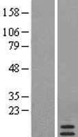 SAA4 Protein (Over-Expression Lysate Myc-DDK (Flag))