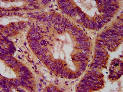 Polyclonal Rabbit anti-Human ELP2 / STATIP1 Antibody (IHC, IF)