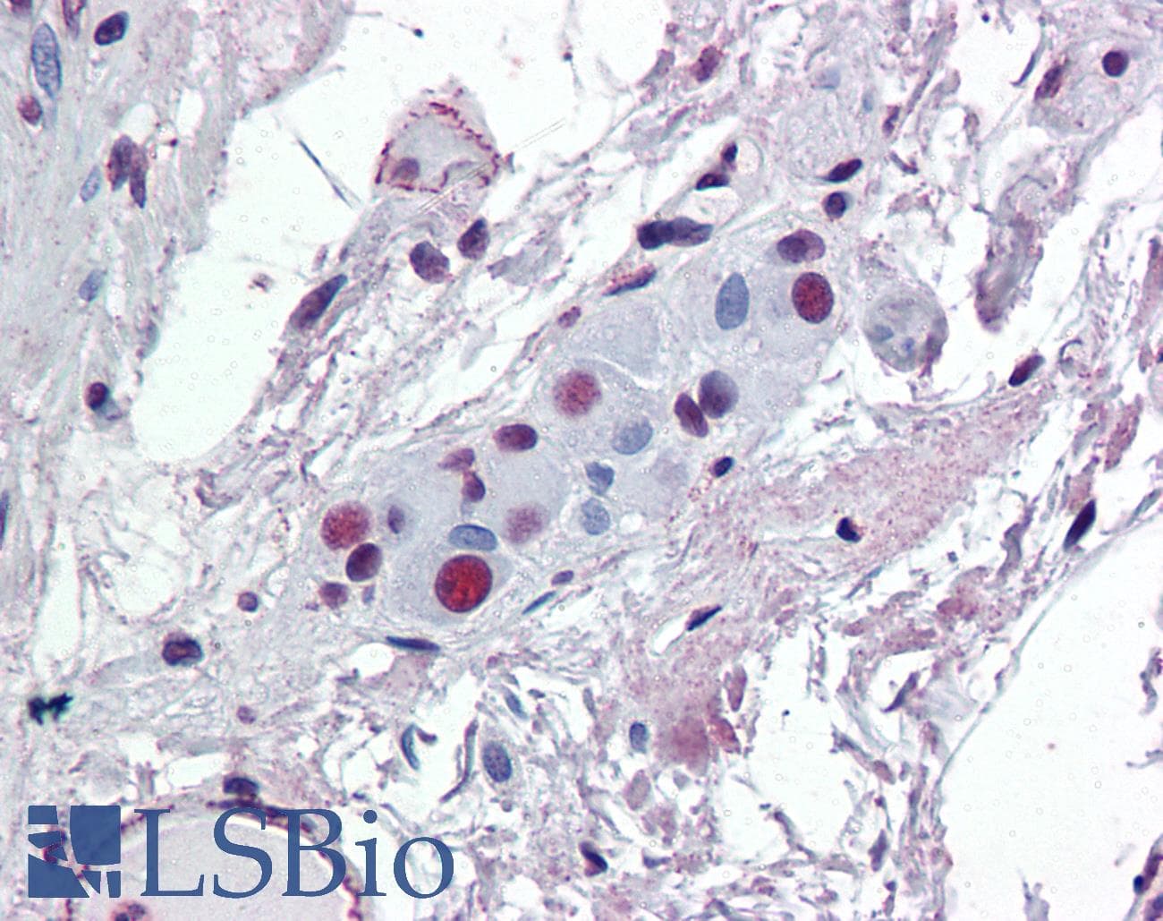 IHC-plus™ ATF2 Antibody (clone 4A3)