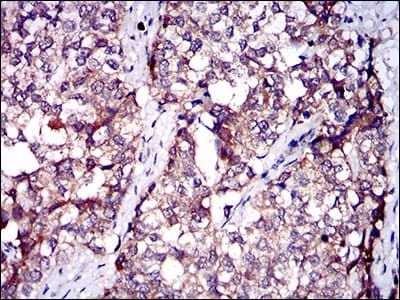SERPINA7 / TBG Antibody (aa168-302, clone 5B11E9)