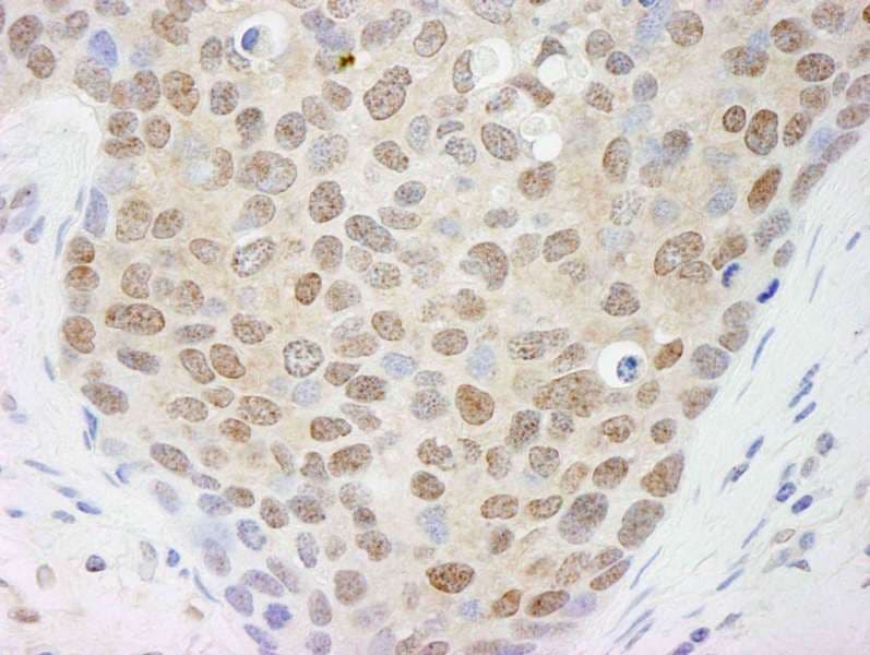 Cullin 4A / CUL4A Antibody (aa700-C-term)