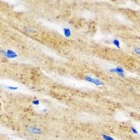 IL18BP Antibody