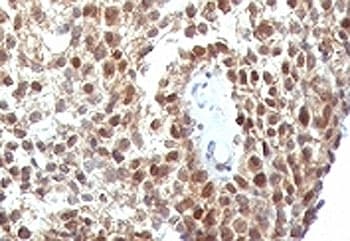 TP53 / p53 Antibody (clone SPM590)
