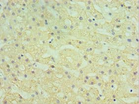 HYAL1 Antibody (aa136-435)