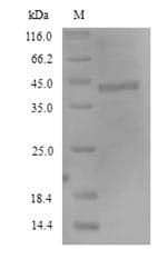 Human FCRL4 / IRTA1 / CD307d Protein (Recombinant 6His, N-terminus)